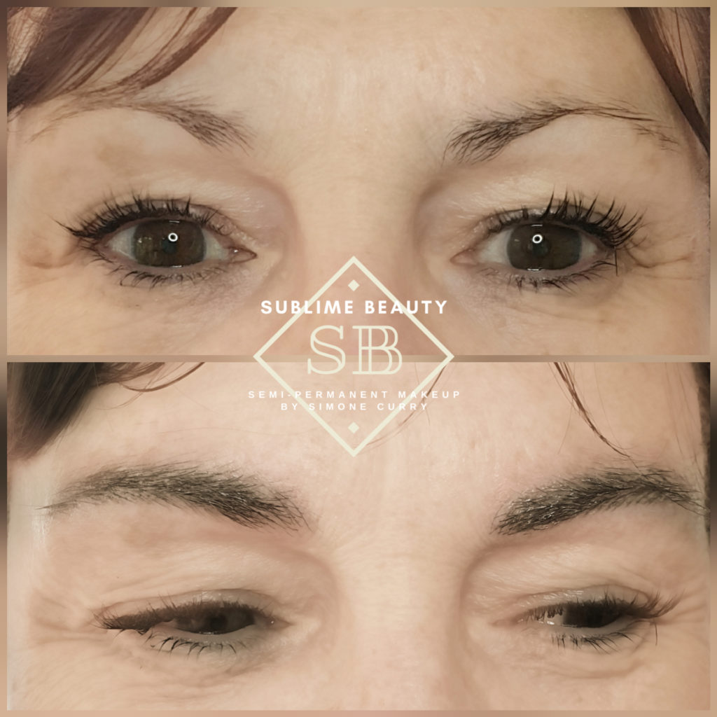 Combination brow before and after treatment