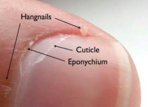 Parts of the fingernail including cuticles and eponychium