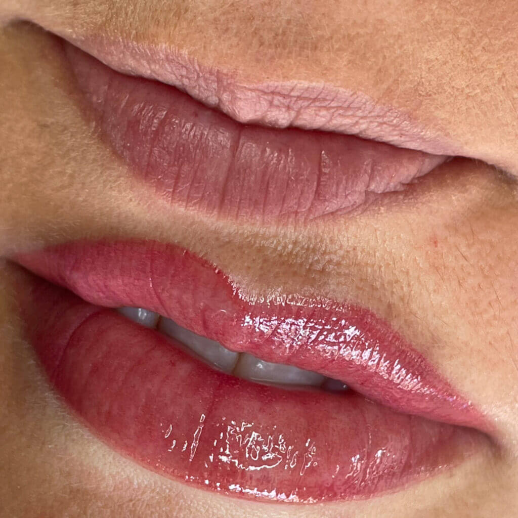 Before and after images illustrating the revitalizing results of lip blush treatment on a woman. The transformation showcases enhanced lip colour, improved definition, and a subtle, youthful radiance, contributing to a fresh and natural appearance.