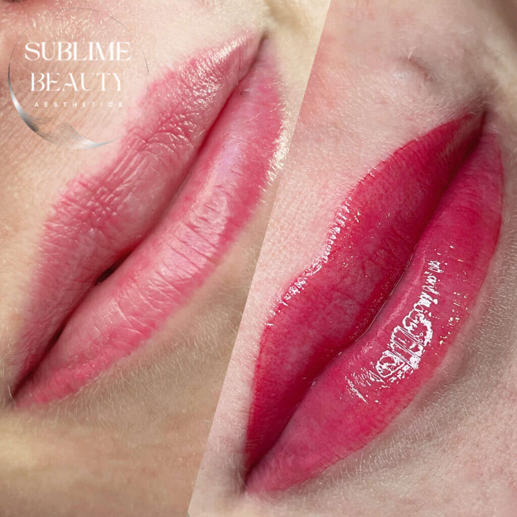 Visible transformation from a lip blush top-up treatment on a woman – the before and after images illustrate enhanced lip colour, improved definition, and a refreshed, natural appearance.